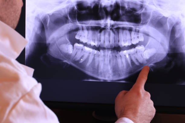 Best Emergency Treatment for Dental Infections or Abscesses in West Peoria, IL